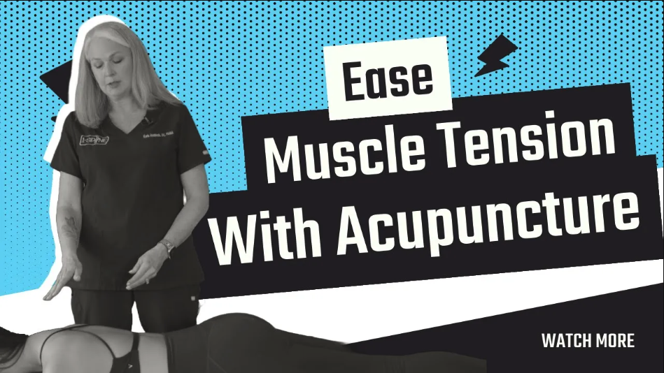 Ease Muscle Tension With Acupuncture | Chiropractor in Lubbock, TX