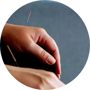 Acupuncture Therapy Chiropractor in Lubbock, TX Near Me Chiropractor for Acupuncture Treatment