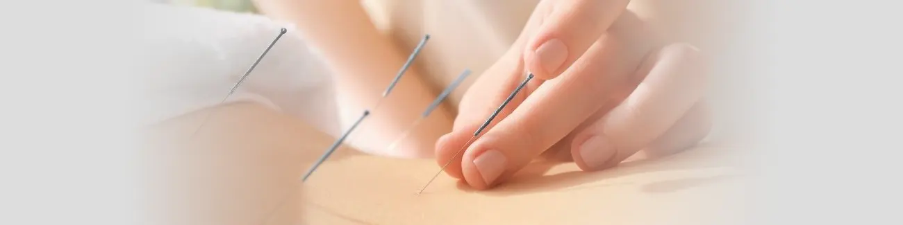 Acupuncture Therapy Treatment Near Me in Lubbock, TX.