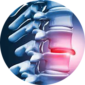 Disc Injury Treatment Near Me in Lubbock, TX. Chiropractor for Disc Injury Relief.