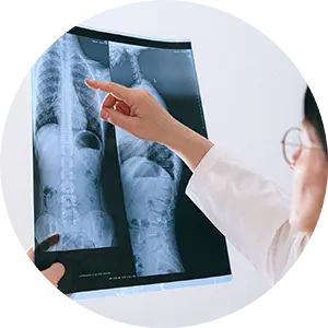 Scoliosis Treatment Chiropractor in Lubbock, TX Near Me Chiropractic Care for Scoliosis